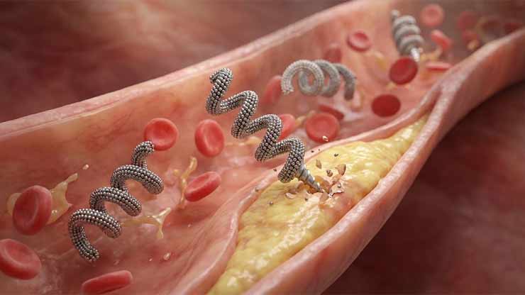 Mikroskopski roboti, nanoboti, za duži ljudski vek mikroskopski roboti